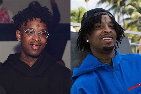 These Rappers Ditched Their Grills for Really Expensive New 